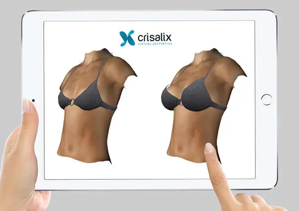 Neck Lift and Mini Neck Lift in Greenville, SC